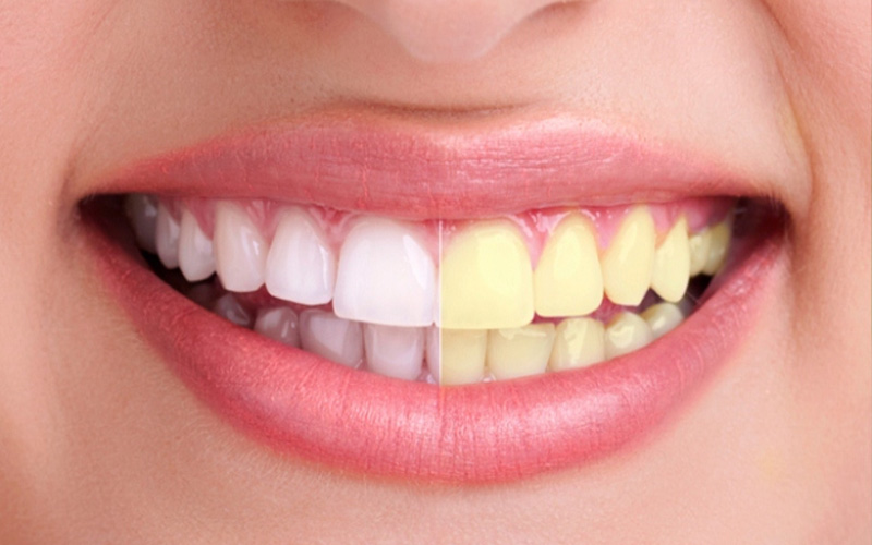 Teeth and mouth care.